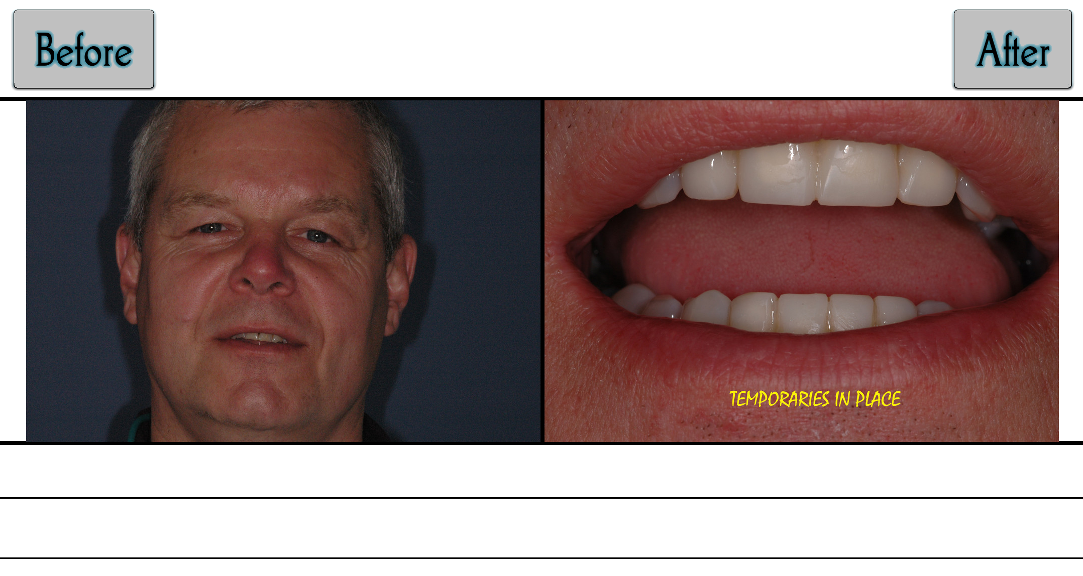 Smile Gallery | DMS Dentistry